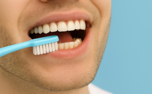 como-cuidar-tus-implantes-dentales